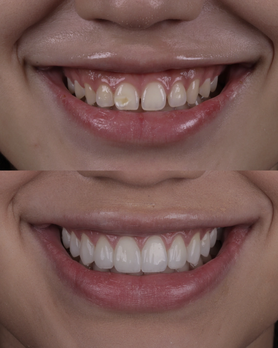 Comparativo clínico original con las fotografías de antes y después, caso 6