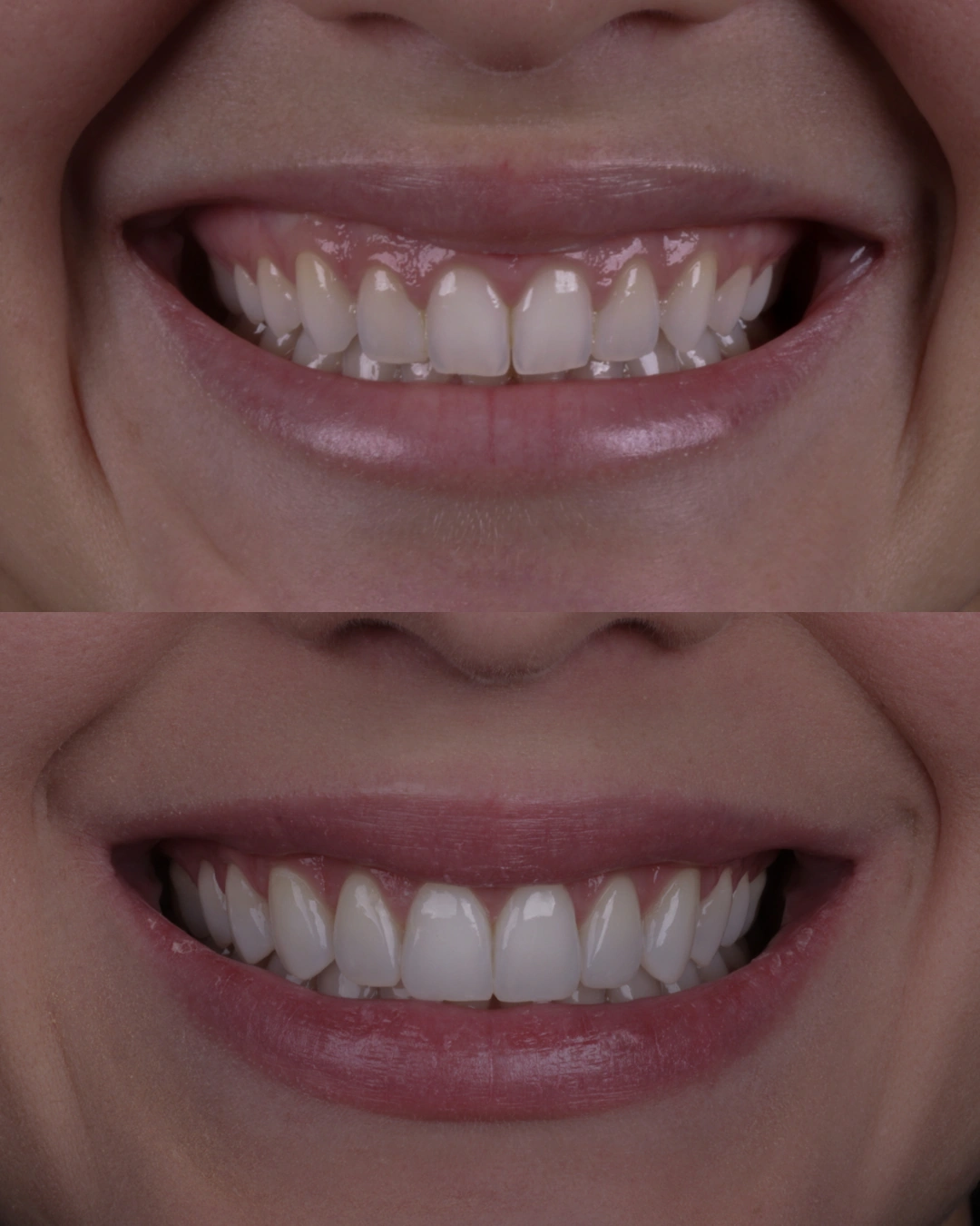Comparativo clínico original con las fotografías de antes y después, caso 9